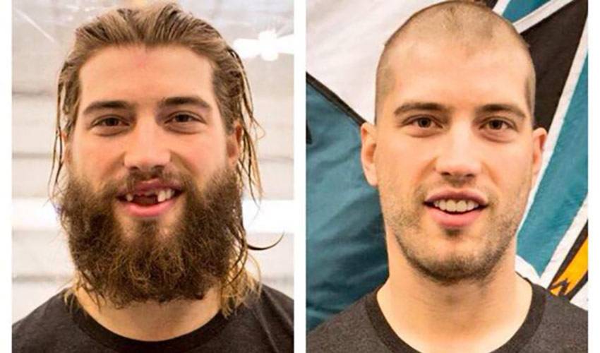 Slapshot on Instagram: The Evolution of Brent Burns… 2005-2022 (projected)